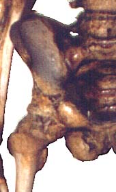 Skelett07.JPG (14940 Byte)