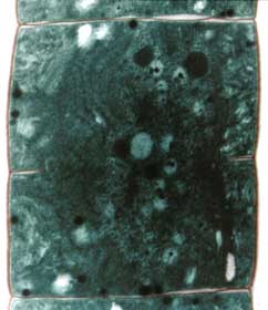 blaualge.JPG (16158 Byte)